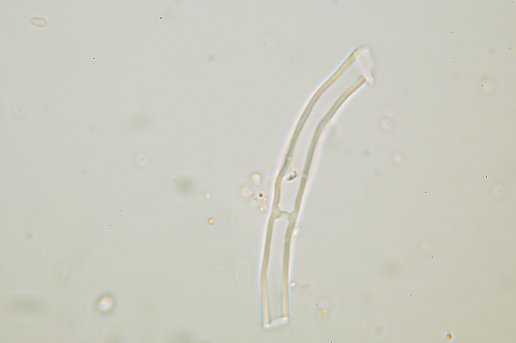 Phanerochaete avellanea  ?